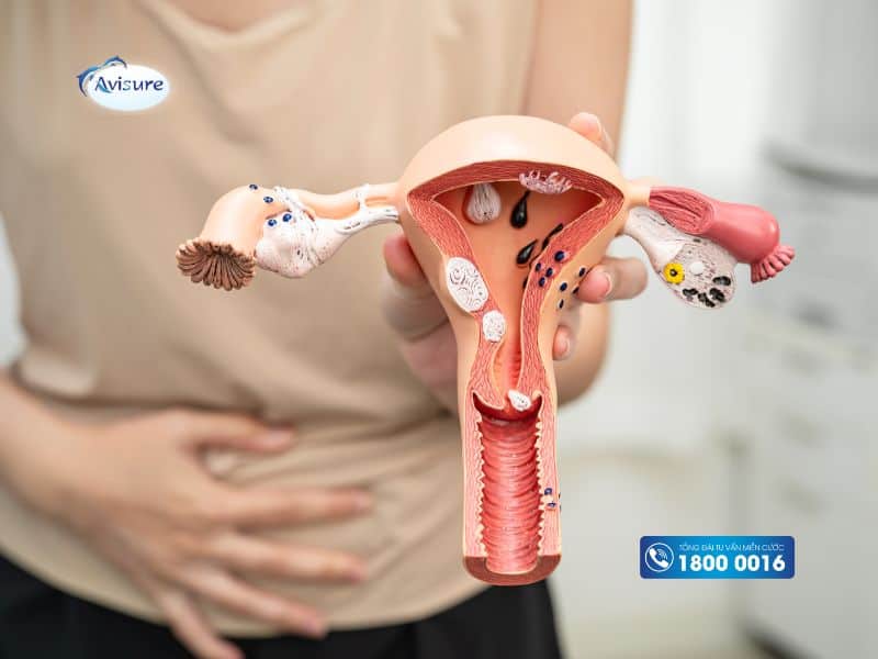 Tử cung ngả sau có sinh thường được không?